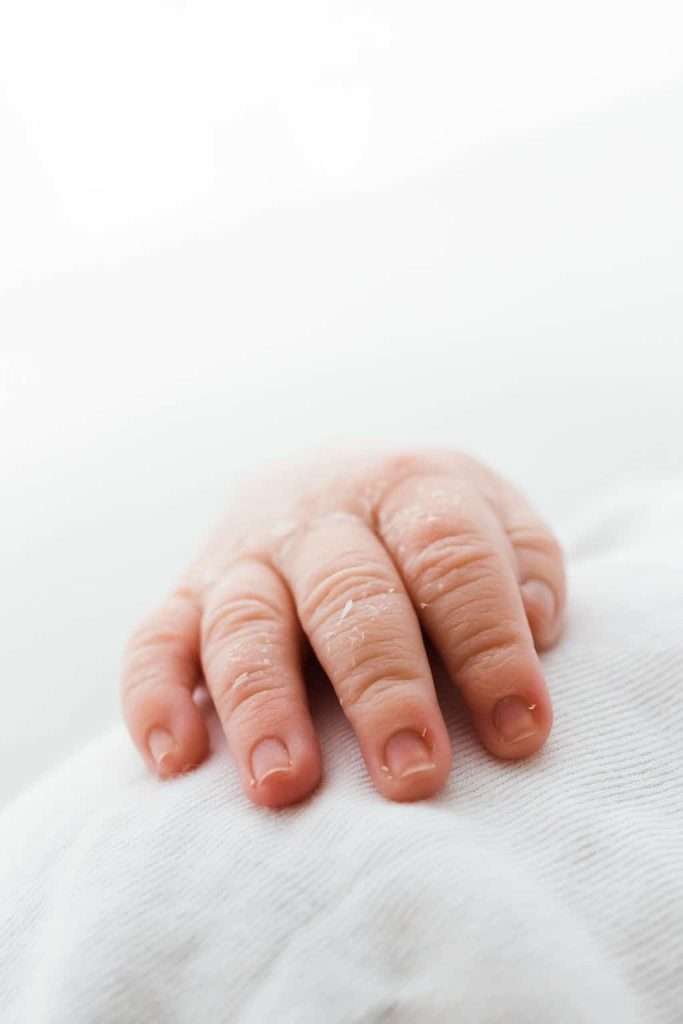 A close-up of a newborn baby's hand resting on a white fabric surface, with visible dry skin on the fingers.